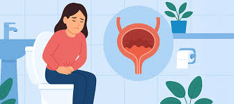 Perubahan Pola Hidup Saat Menghadapi Cystitis